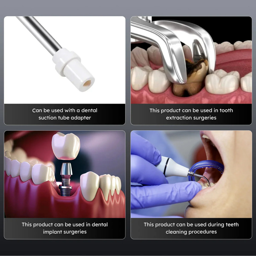 1 dona AZDENT Dental zanglamaydigan po'latdan yasalgan tupurik ejektori jarrohlik qo'shimchasi Yupqa dizayndagi past assimilyatsiya trubkasi stomatologik material