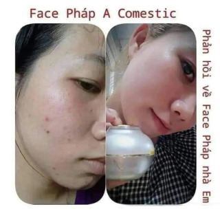 Kem D Panger Tr너 Da Faceembali A Cosmetic 50g M Lichtrene, Brighten Skin, Hydrate & Nourish, Отбеливающий уход за лицом